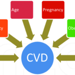 Chronic Venous Insufficiency: What You Need to Know About Risk Factors