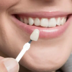 Transform Your Smile with Cosmetic Dentistry for a New You