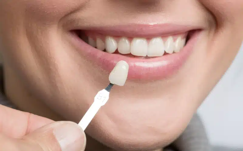 Transform Your Smile with Cosmetic Dentistry for a New You