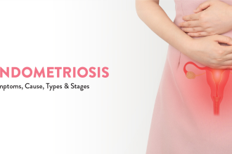 When To Seek Treatment for Endometriosis